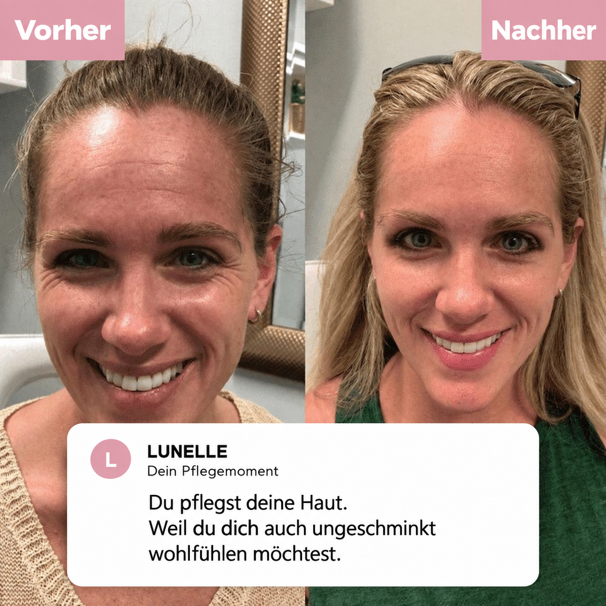 LUNELLE