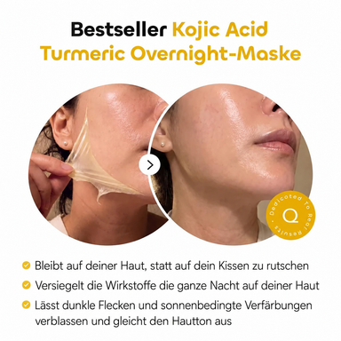 NIVARA™ Spot Reset Mask